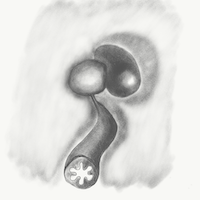 disease story