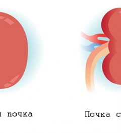 disease story