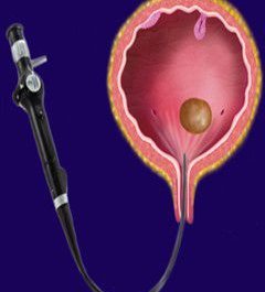 disease story