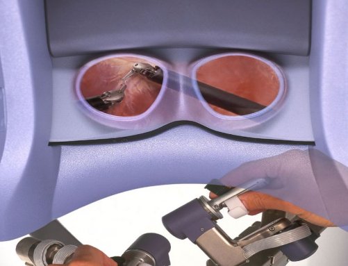 Оптическое 3D увеличение